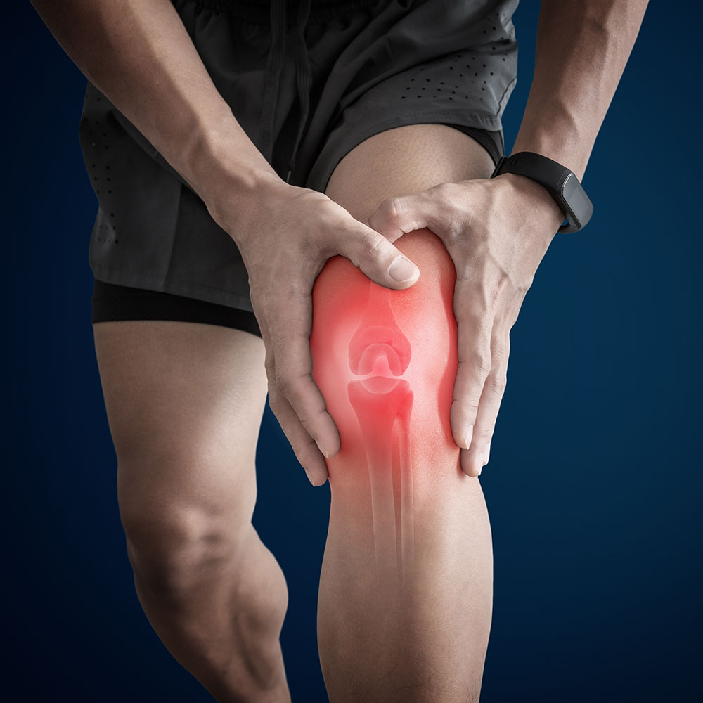 arthritis-rheuma Sportler mit Arthritis Schmerzen Knie
